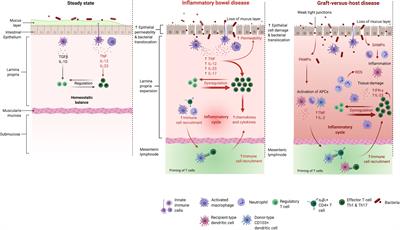 Interfering With Inflammation: Heterogeneous Effects of Interferons in Graft-Versus-Host Disease of the Gastrointestinal Tract and Inflammatory Bowel Disease